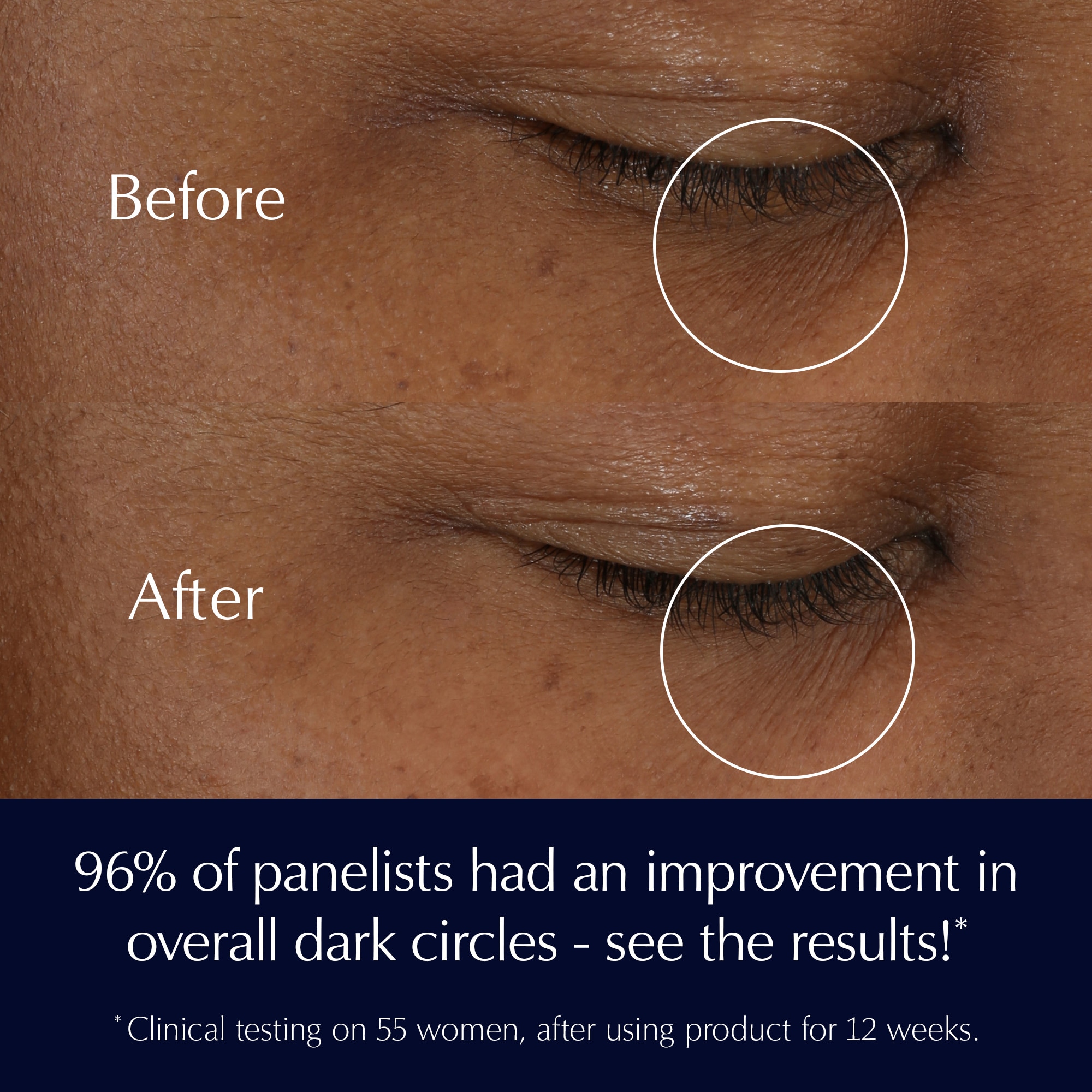 Advanced Night Repair Eye Cream Skincare Set Repair + Brighten + Hydrate - Image 4