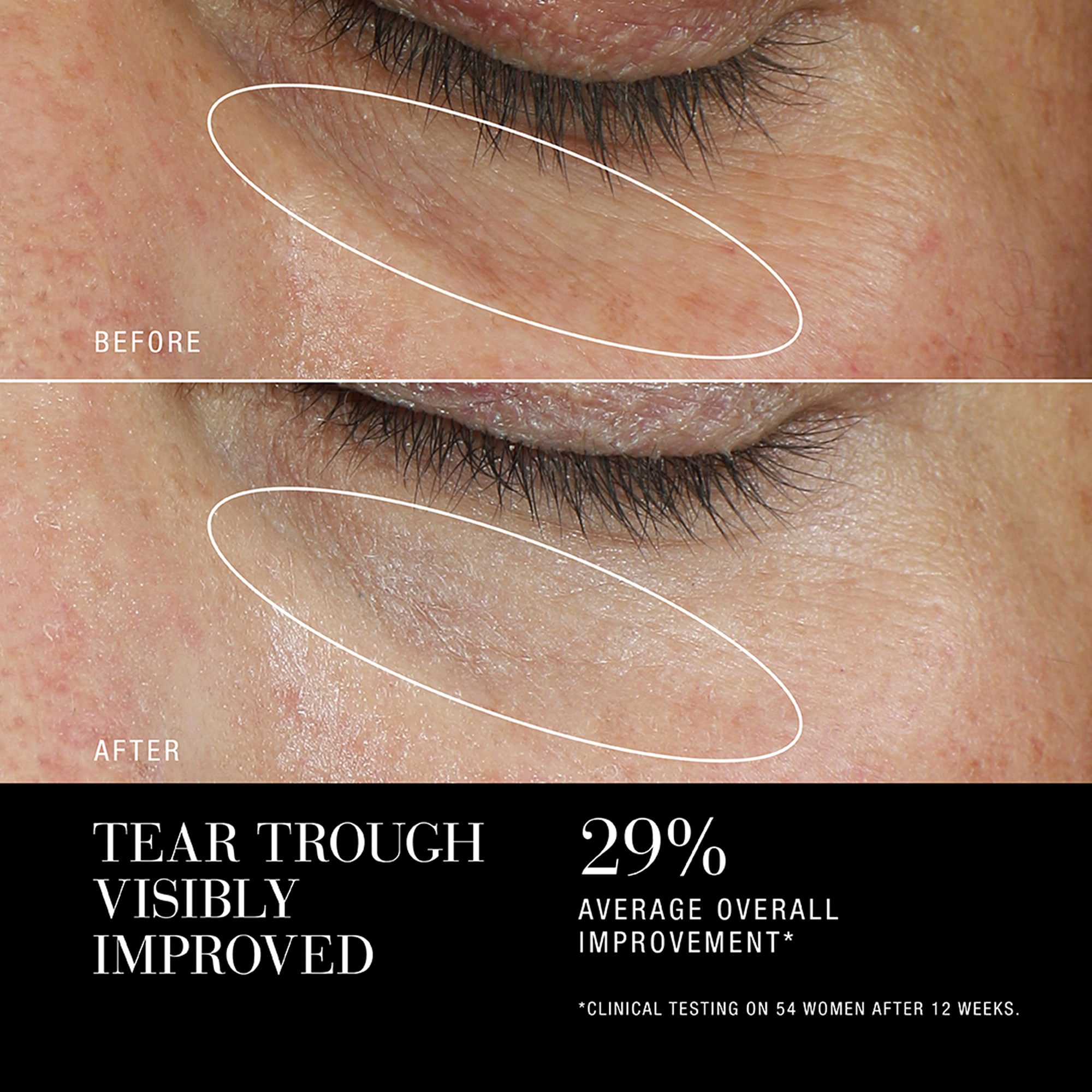 Re-Nutriv Ultimate Diamond Age Reversal | Skin Longevity Eye Cream - Image 5