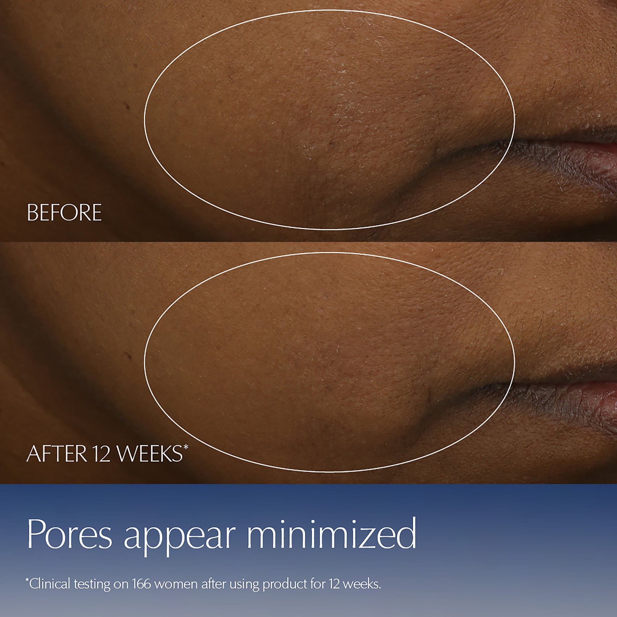 Advanced Night Repair Serum Duo Synchronized Multi-Recovery Complex - Image 9