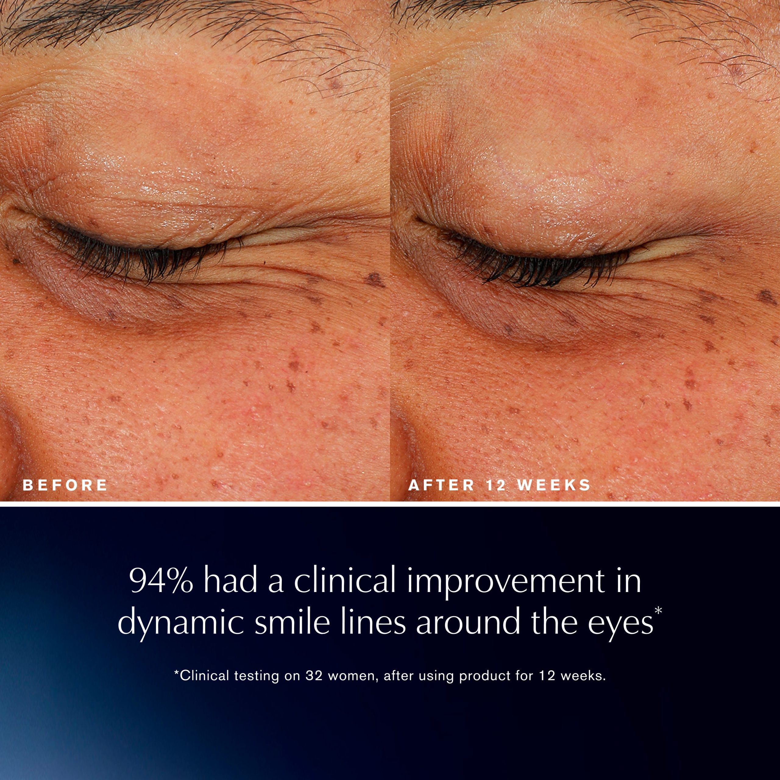 Advanced Night Repair Eye Lift + Sculpt Eye Cream - Image 5