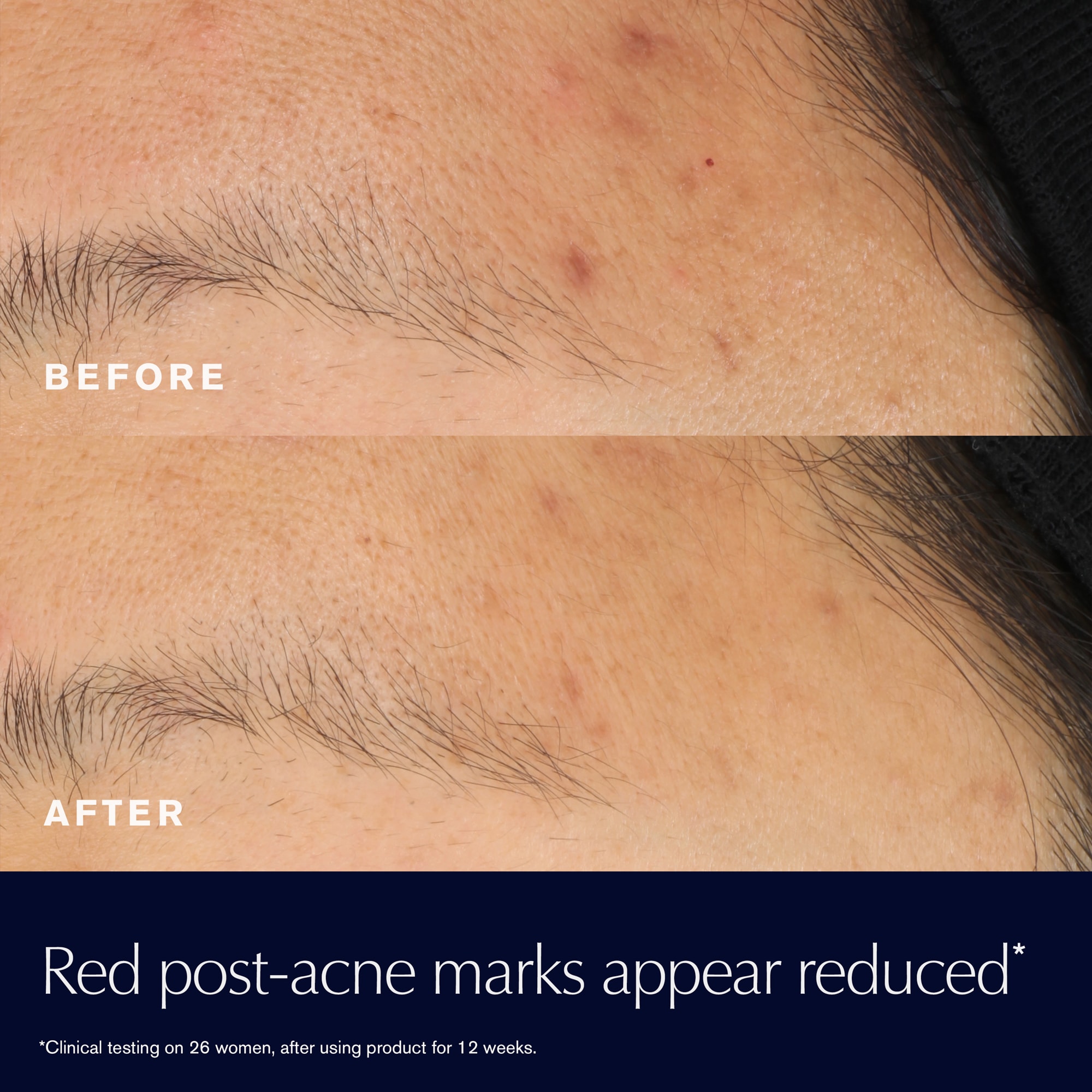 Advanced Night Repair Rescue Solution Serum with 15% Bifidus Ferment - Image 4
